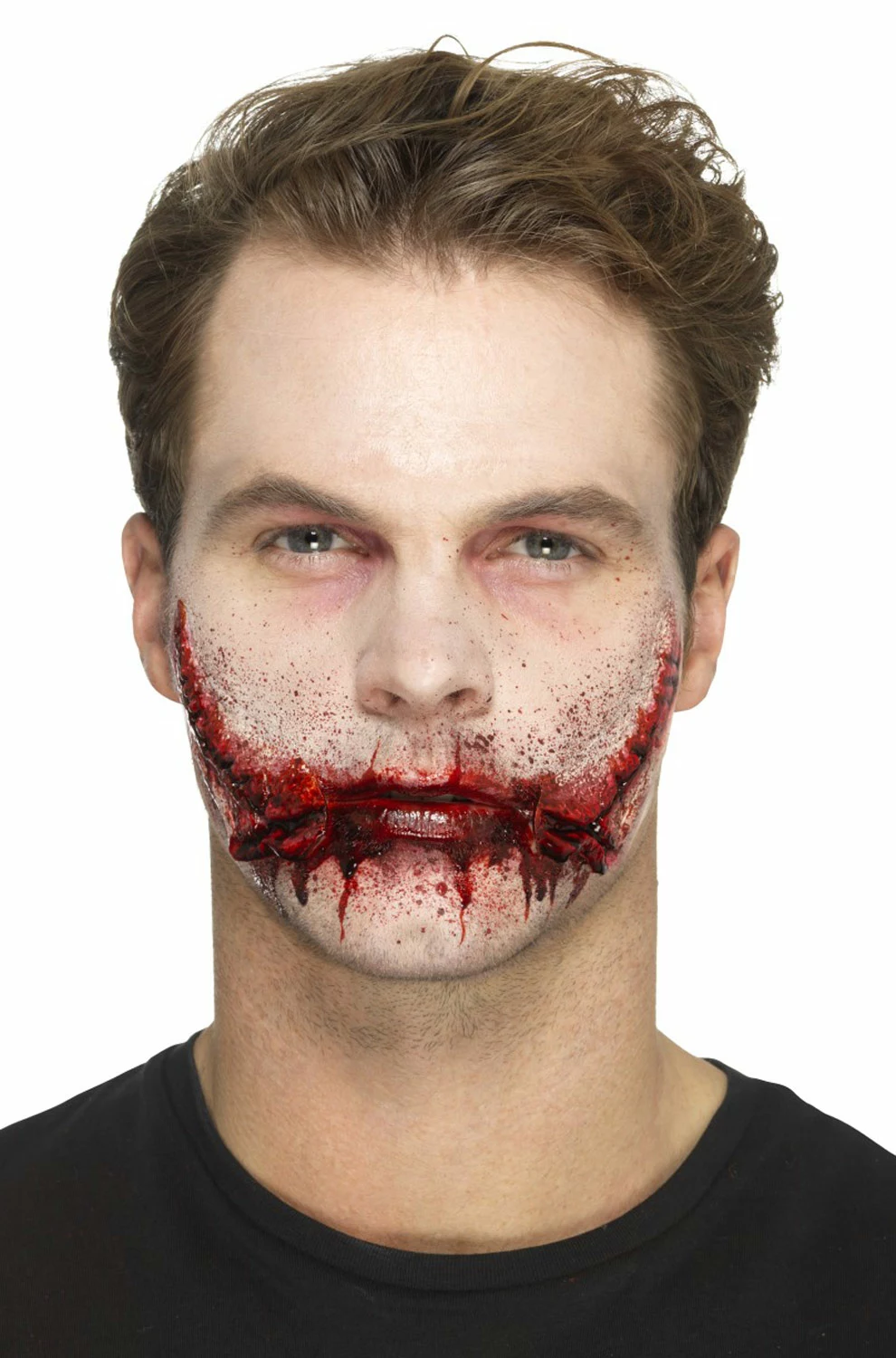 Stitched Smile Prosthetic